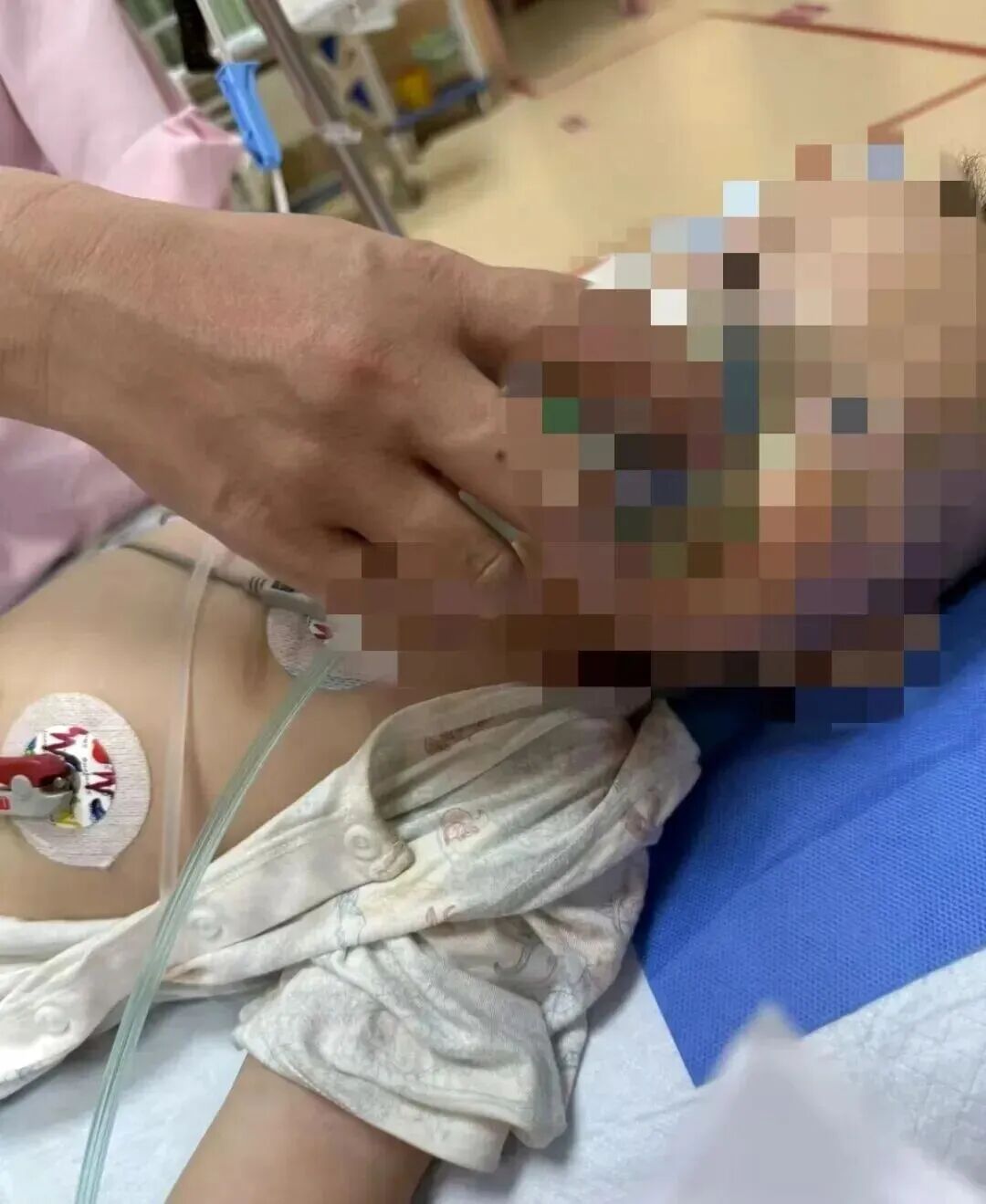 蛋壳暗藏针孔！1 岁宝宝吃下邻居投毒的鸡蛋，3次病危抢救后留下严重后遗症，邻居自首称“想毒黄鼠狼”……